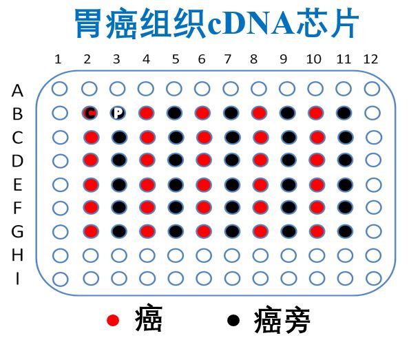 生存期肿瘤组织cDNA芯片