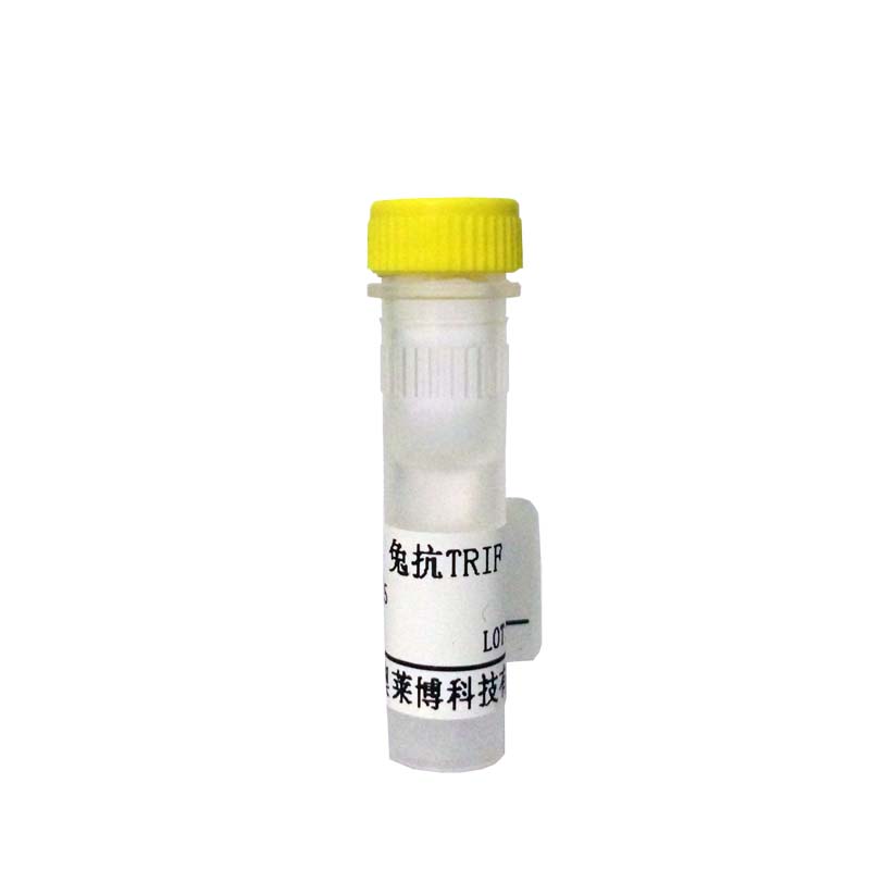 山羊抗人IgM抗体(BIOTIN标记) BIOTIN标记抗体