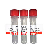 末端多聚腺苷酸2蛋白抗体折扣价