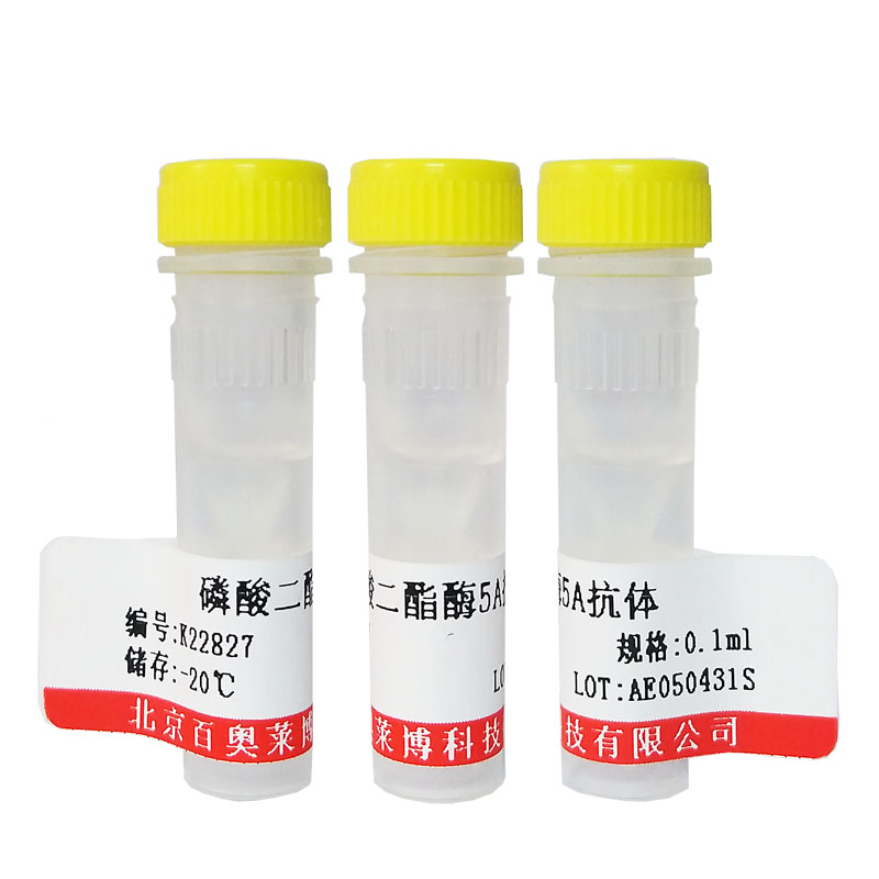 北京现货嗜中性粒细胞抗原CD177抗体特价优惠