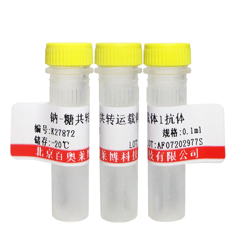 北京K24072型磷酸化视网膜母细胞瘤相关蛋白1抗体现货价格