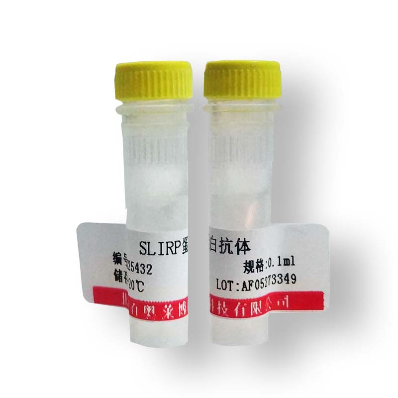 北京K22333型输卵管特异性糖蛋白抗体品牌