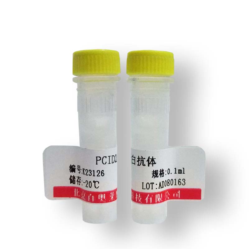 异柠檬酸脱氢酶3 beta亚基抗体(国产,进口)