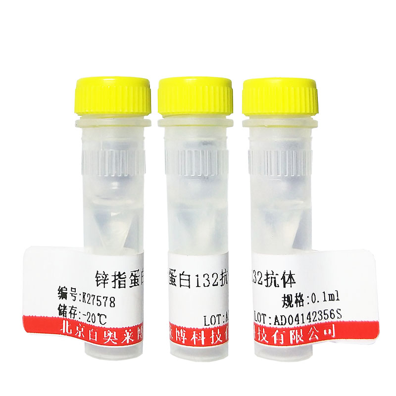 北京蛋白质磷酸酶1G抗体(PP2Cγ)优惠促销