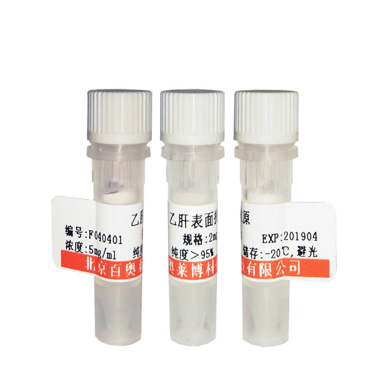 北京现货S100钙结合蛋白A10抗体优惠