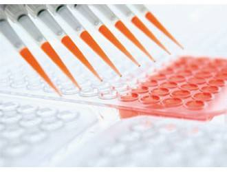 呼吸道传染病RT-PCR检测试剂