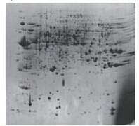 植物总蛋白质微量提取试剂 (2DE)