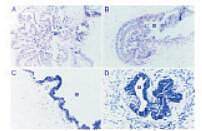 预混型BCIP/NBT溶液