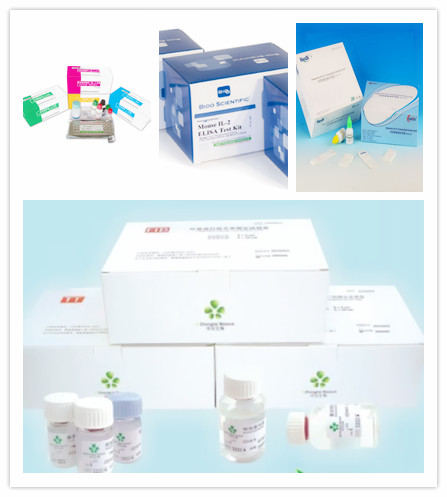 人抗巨细胞病毒抗体IgG(anti-CMV IgG)ELISA Kit