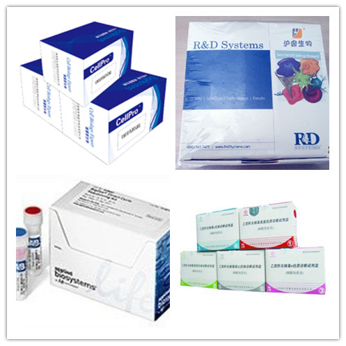 人腺病毒IgM(ADV-IgM)ELISA Kit