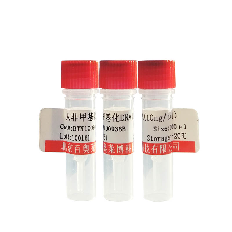 GL0627型淀粉样物质染色液(Highman刚果红法)优惠