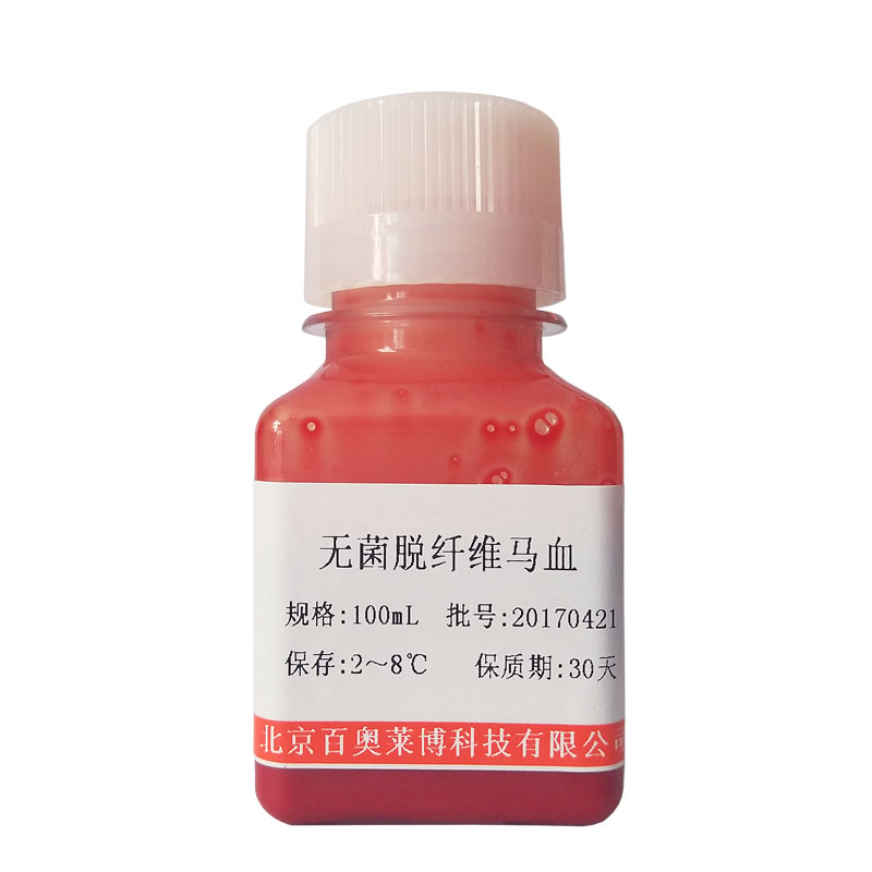 兔抗人IgG(H+L)抗血清 免疫血清