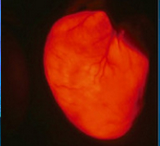 AAV在心脏中的注射及表达
