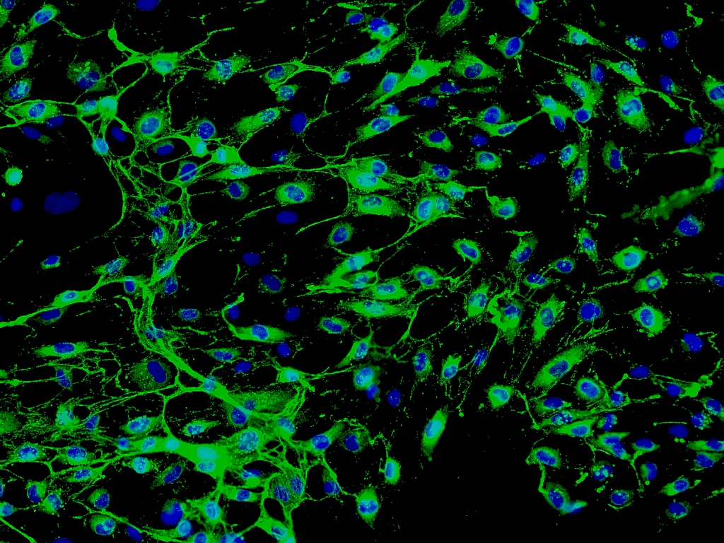 RT-112、RT112;人膀胱癌细胞