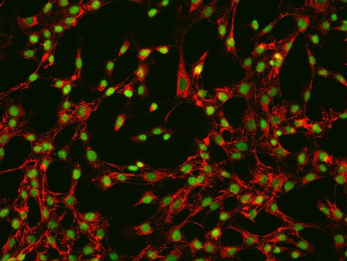 SNU-216、SNU216;人胃癌细胞