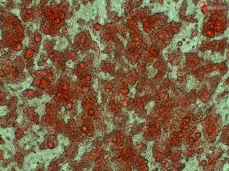 NCI-H3122、H3122;人肺癌细胞