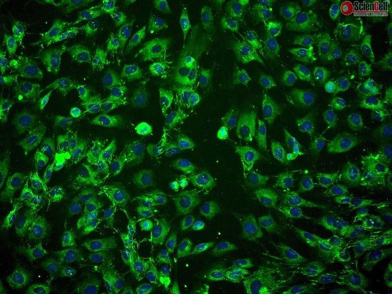 SHG-44（SHG44）人胶质瘤细胞，人星形胶质细胞瘤细胞