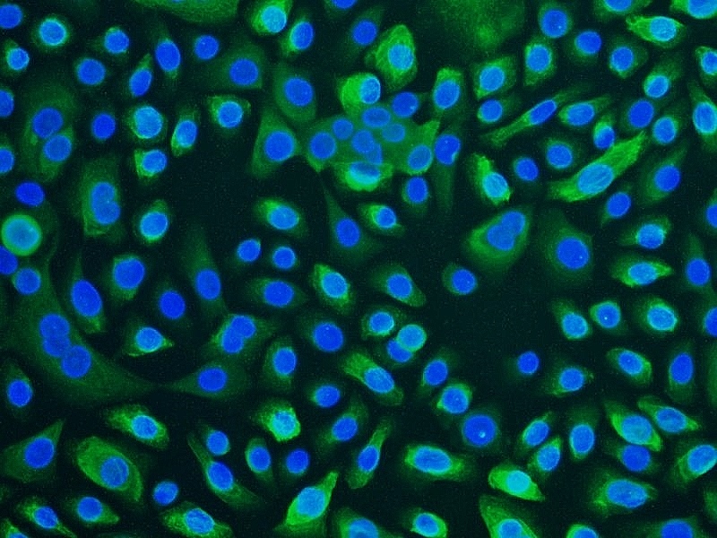 TPC-1人乳头瘤状甲状腺癌细胞