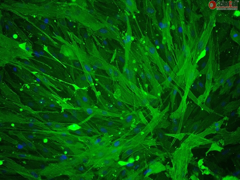 MCF7 [MCF-7]人乳腺癌细胞