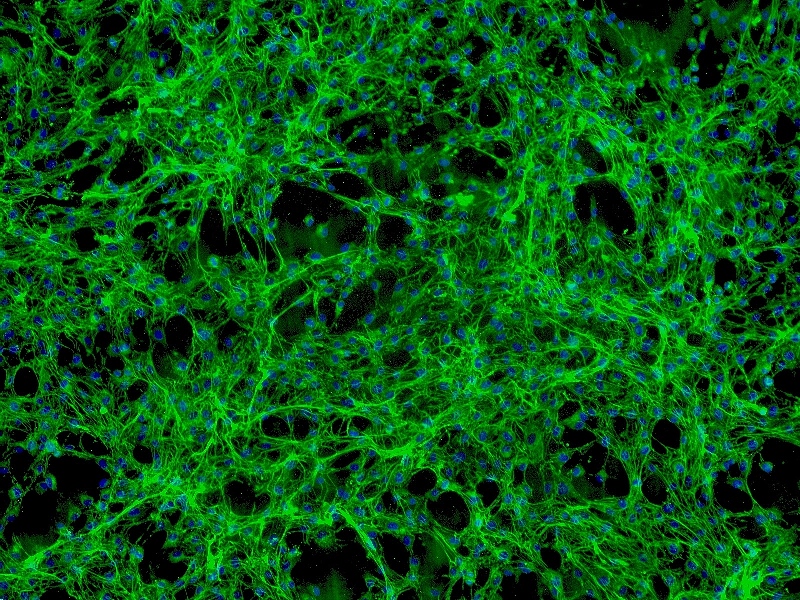 VSC4.1脊髓前角运动神经元瘤细胞系