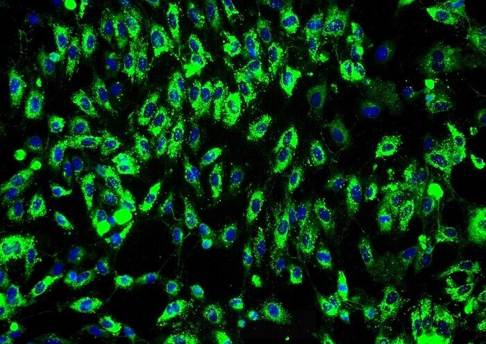MDA-MB-468人乳腺癌细胞