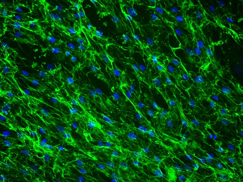 Daudi人淋巴瘤细胞