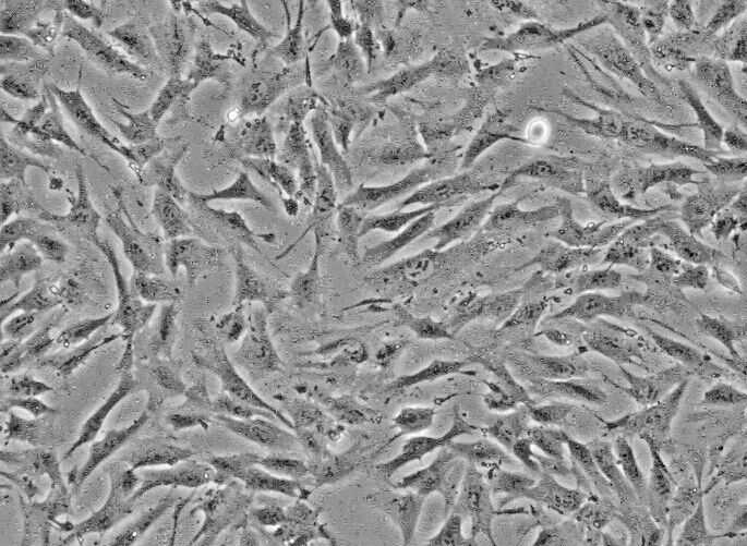 ES-2人卵巢透明癌细胞