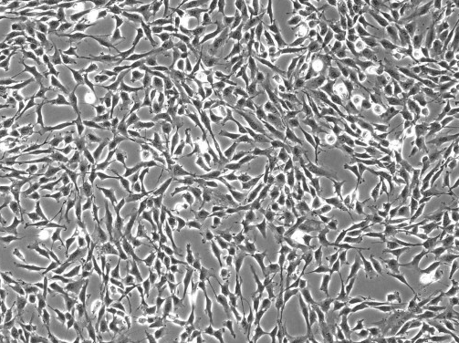 DMS153人小细胞肺癌细胞
