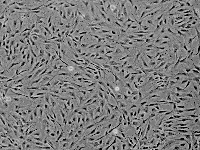B16-F1小鼠黑色素瘤细胞