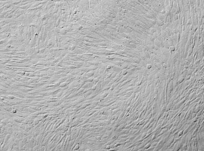 293FT;表达SV40T抗原人胚肾上皮细胞