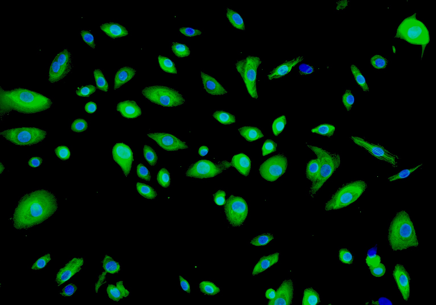 PT-K75;猪鼻甲黏膜成纤维细胞