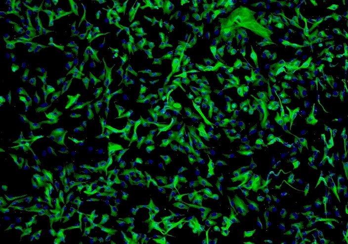 CT26.WT小鼠结肠癌细胞