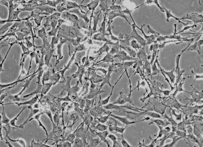 Colon26小鼠结肠癌细胞