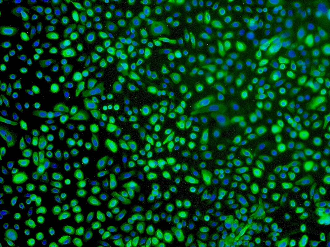 U14小鼠子宫颈癌细胞