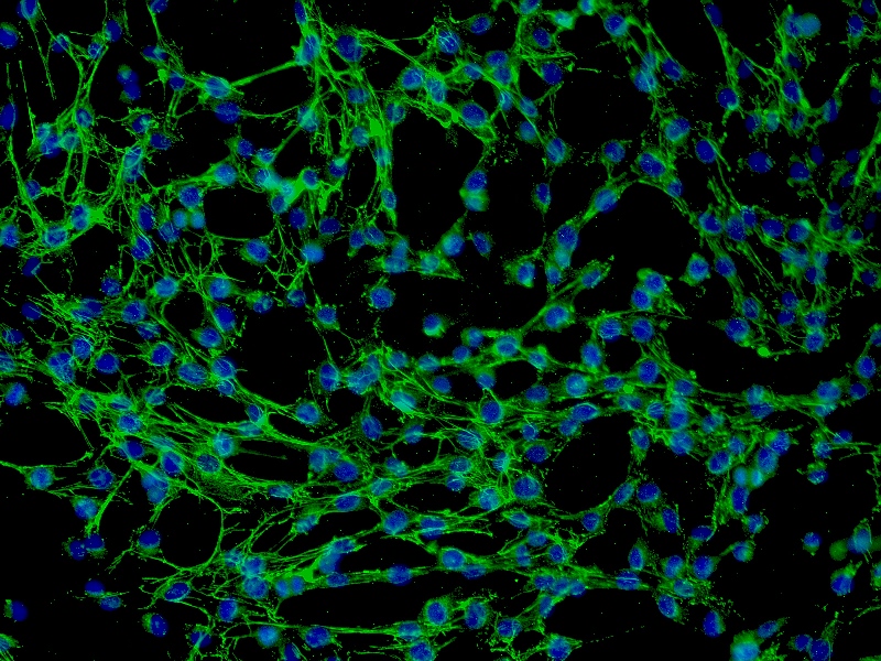 Y3-Ag 1.2.3大鼠骨髓瘤细胞