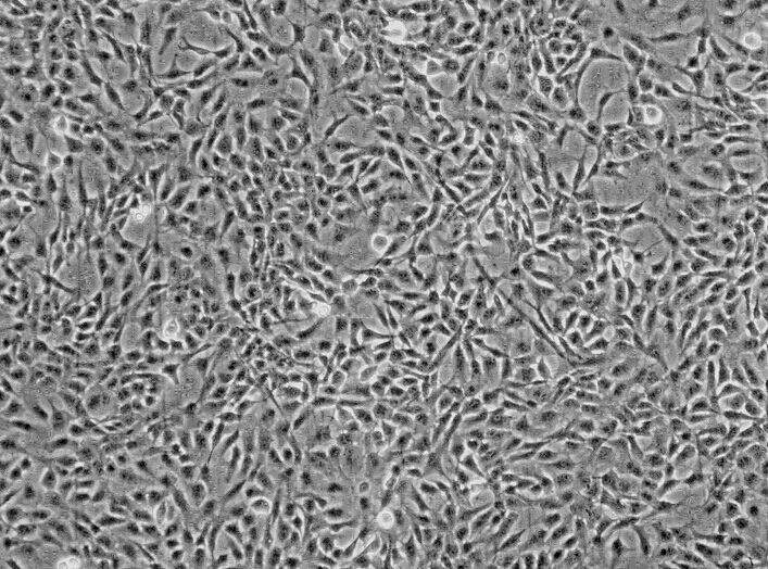 CBRH7919（CBRH-7919）大鼠肝癌细胞