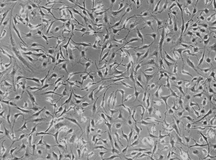 RH-35大鼠肝癌细胞