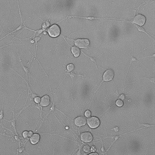 DRG patch clamp|离子通道|药物筛选服务