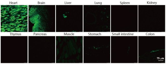 AAV在心脏中的注射及表达