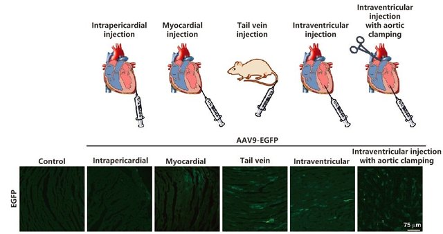 AAV在心脏中的注射及表达
