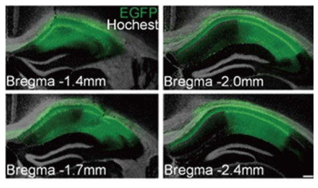 RNA干扰/RNAi/基因沉默/siRNA/miRNA