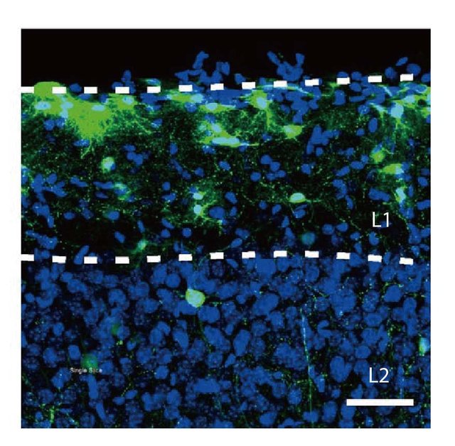 RNA干扰/RNAi/基因沉默/siRNA/miRNA