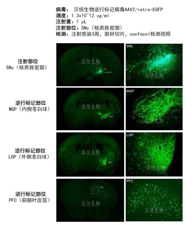 汉恒生物现隆重推出神经逆行示踪AAV-Retro腺相关病毒