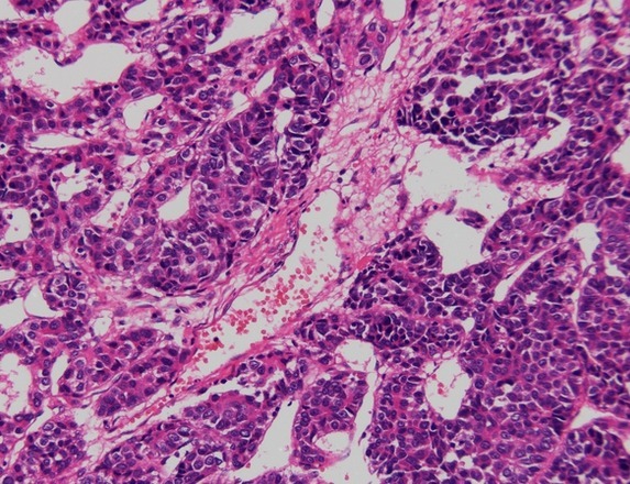 HE染色，HE染色实验代测-上海信帆生物