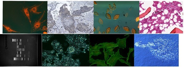 500万像素显微镜摄像头