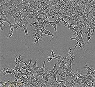 细胞迁移/细胞划痕实验