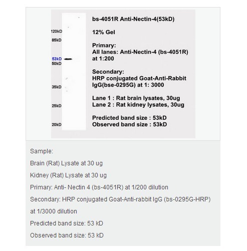 髓过氧化物酶抗中性粒细胞胞质IgG抗体
