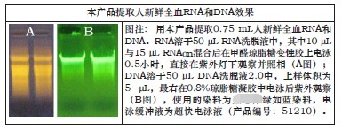 柱式血液DNA-RNAOUT