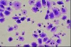 细胞迁移/Transwell