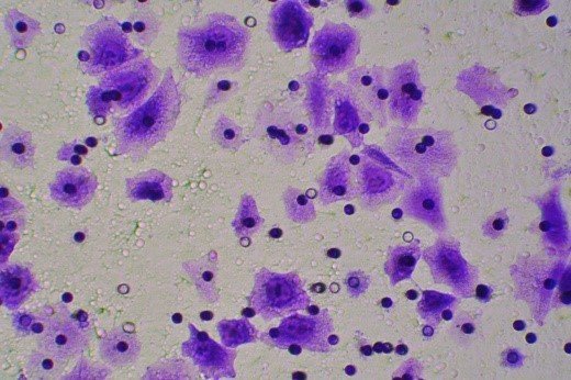 细胞迁移/Transwell